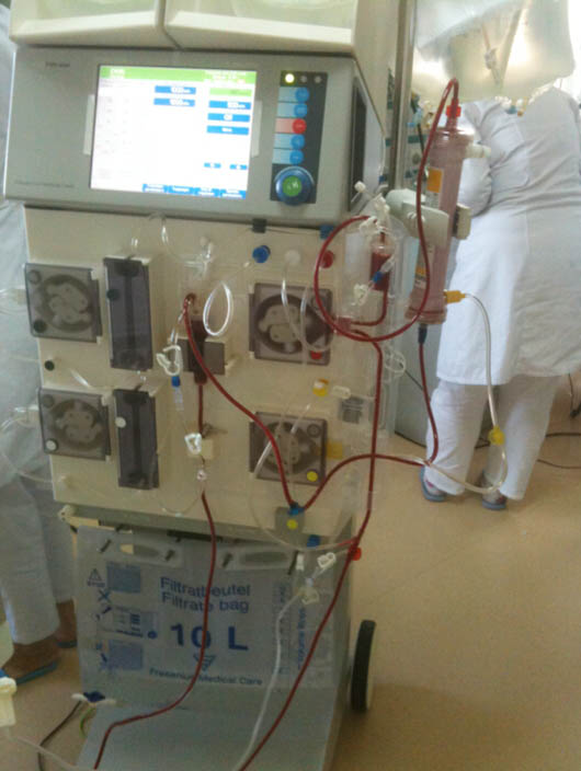 床旁血液凈化治療中